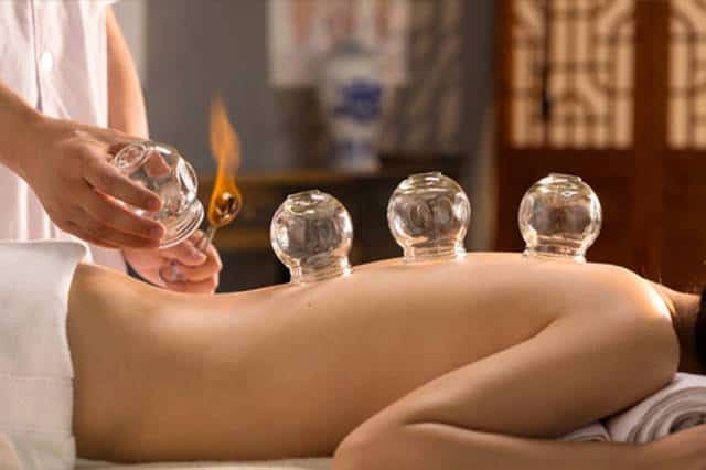 Photo Cupping-therapy-traditional-